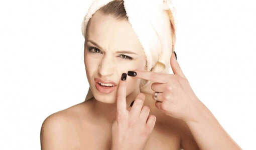 how-to-hide-pimples