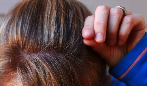 why-does-hair-turn-white